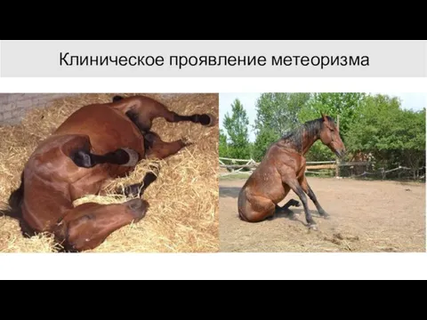 Клиническое проявление метеоризма