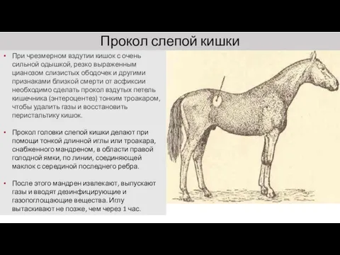 Прокол слепой кишки При чрезмерном вздутии кишок с очень сильной одышкой,