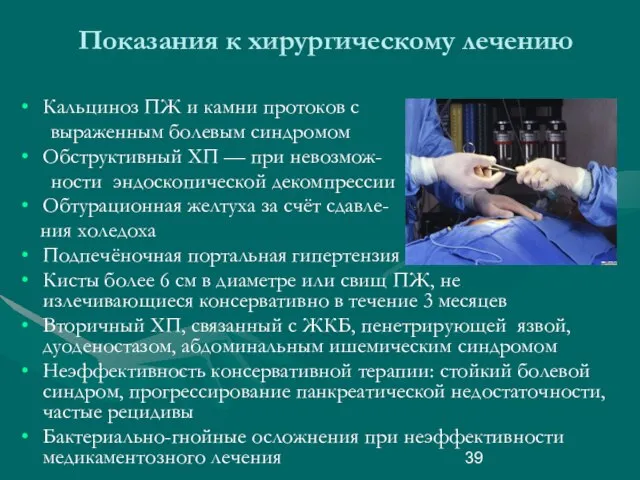 Показания к хирургическому лечению Кальциноз ПЖ и камни протоков с выраженным