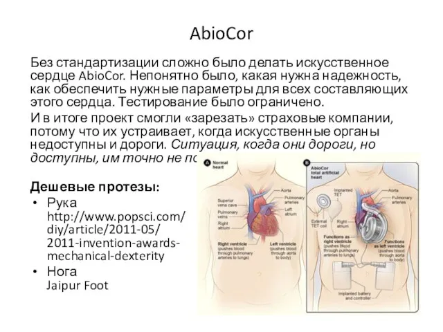 AbioCor Без стандартизации сложно было делать искусственное сердце AbioCor. Непонятно было,