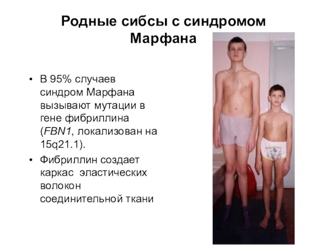 Родные сибсы с синдромом Марфана В 95% случаев синдром Марфана вызывают