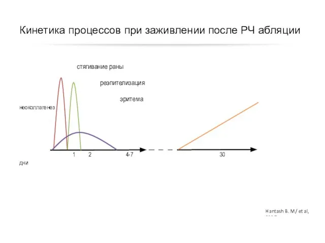 Кинетика процессов при заживлении после РЧ абляции стягивание раны реэпителизация эритема