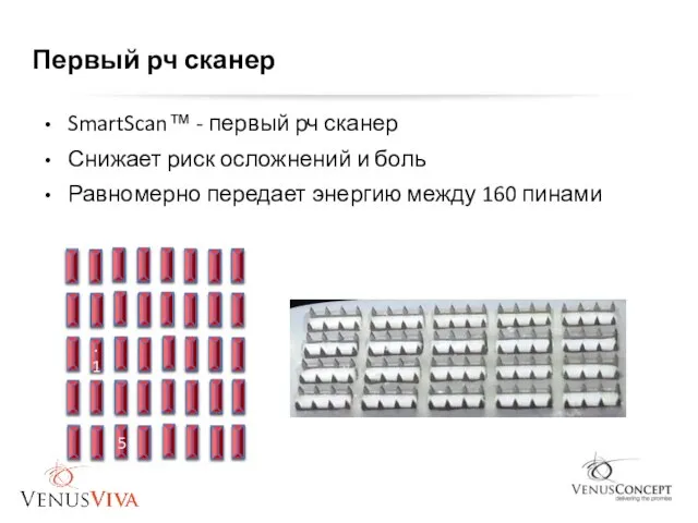 Первый рч сканер SmartScan™ - первый рч сканер Снижает риск осложнений