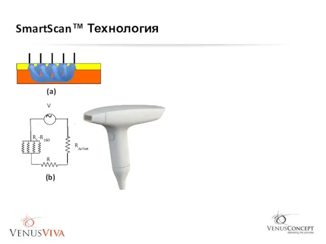 (a) RActive (b) R V R1-R160 SmartScan™ Технология