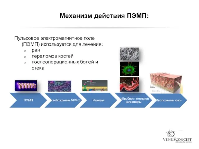 Механизм действия ПЭМП: Пульсовое электромагнитное поле (ПЭМП) используется для лечения: ран