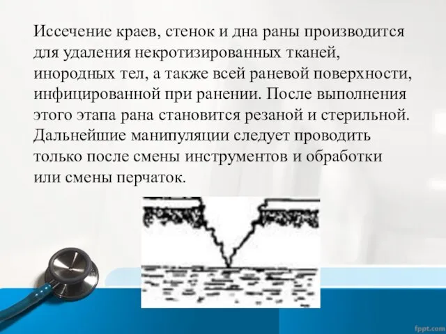 Иссечение краев, стенок и дна раны производится для удаления некротизированных тканей,