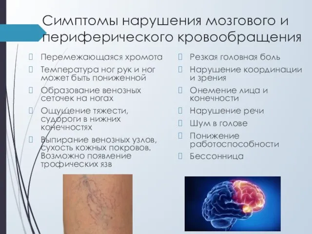 Симптомы нарушения мозгового и периферического кровообращения Перемежающаяся хромота Температура ног рук