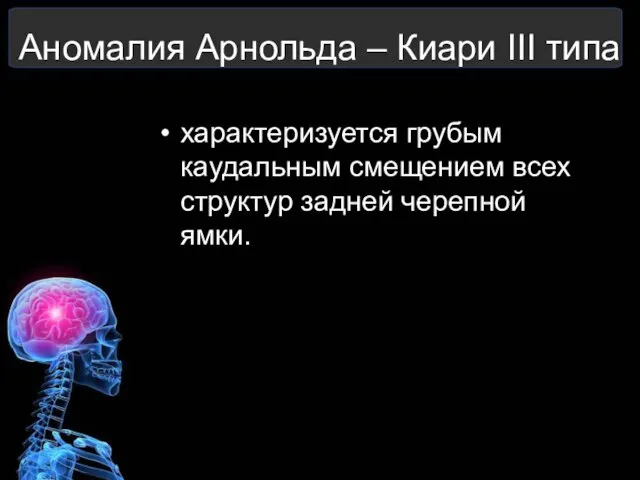 Аномалия Арнольда – Киари III типа характеризуется грубым каудальным смещением всех структур задней черепной ямки.