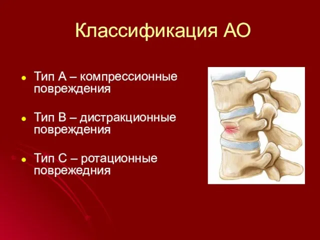 Классификация АО Тип А – компрессионные повреждения Тип В – дистракционные