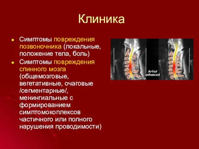 Клиника Симптомы повреждения позвоночника (локальные, положение тела, боль) Симптомы повреждения спинного