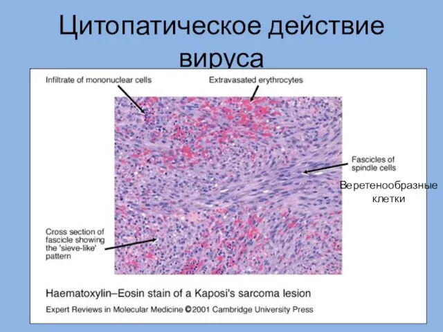 Цитопатическое действие вируса Веретенообразные клетки