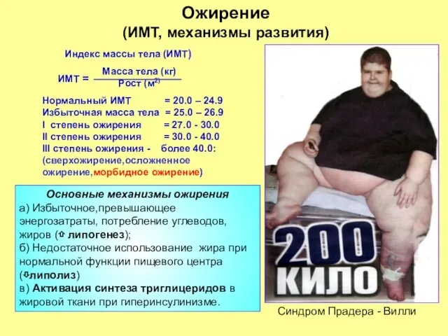 Ожирение (ИМТ, механизмы развития) Нормальный ИМТ = 20.0 – 24.9 Избыточная