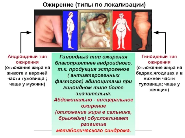 Ожирение (типы по локализации) Андроидный тип ожирения (отложение жира на животе