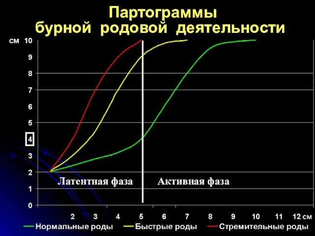 Партограммы бурной родовой деятельности Латентная фаза Активная фаза