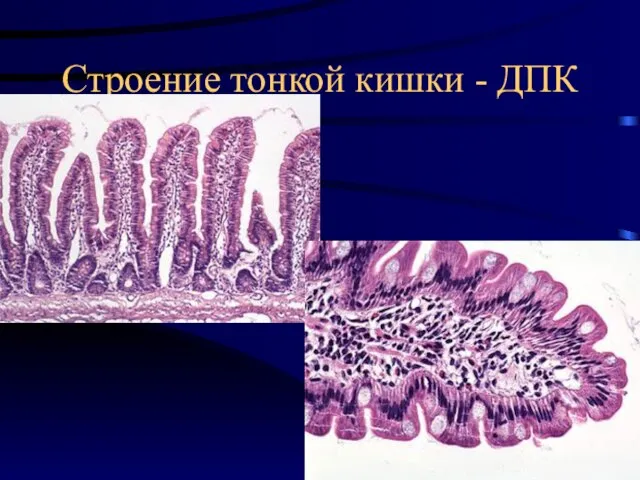 Строение тонкой кишки - ДПК