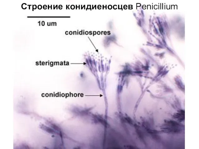 Строение конидиеносцев Penicillium