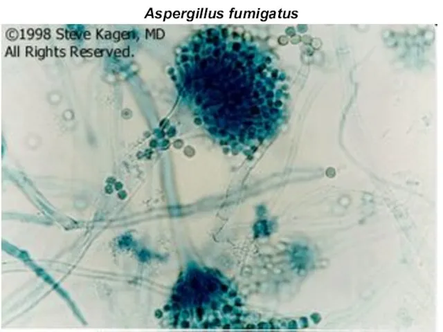 Aspergillus fumigatus