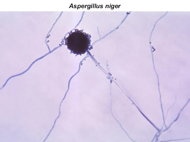 Aspergillus niger