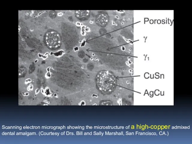 Scanning electron micrograph showing the microstructure of a high-copper admixed dental