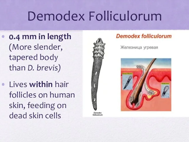 Demodex Folliculorum 0.4 mm in length (More slender, tapered body than
