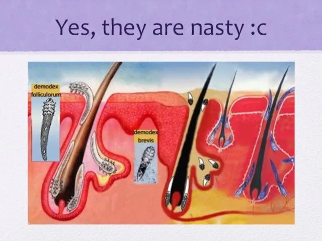 Yes, they are nasty :c