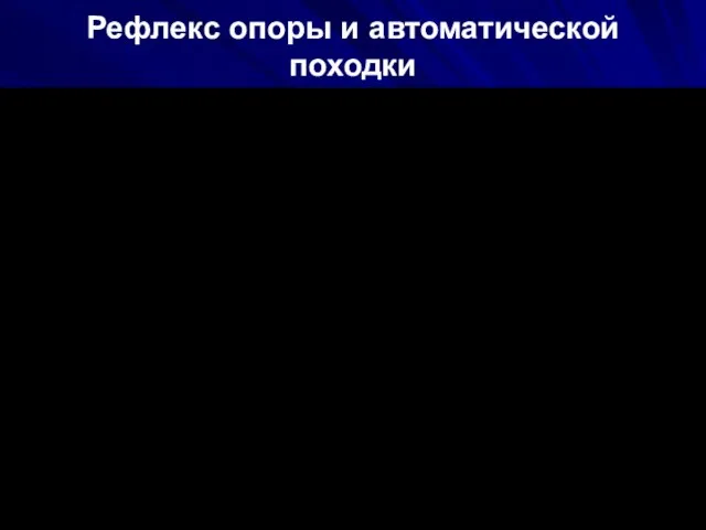 Рефлекс опоры и автоматической походки