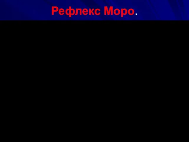 Рефлекс Моро.