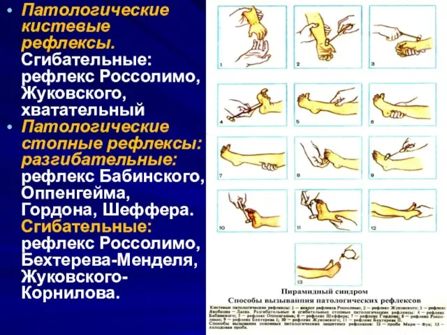 Патологические кистевые рефлексы. Сгибательные: рефлекс Россолимо, Жуковского, хватательный Патологические стопные рефлексы: