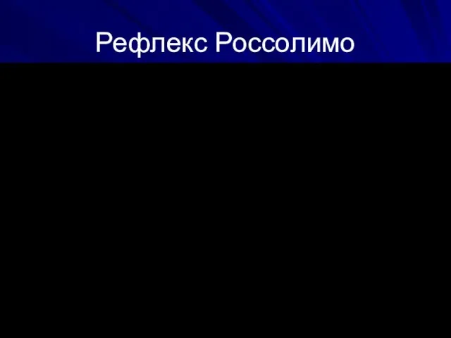 Рефлекс Россолимо