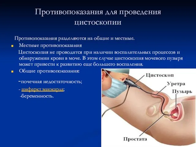 Противопоказания для проведения цистоскопии Противопоказания разделяются на общие и местные. Местные