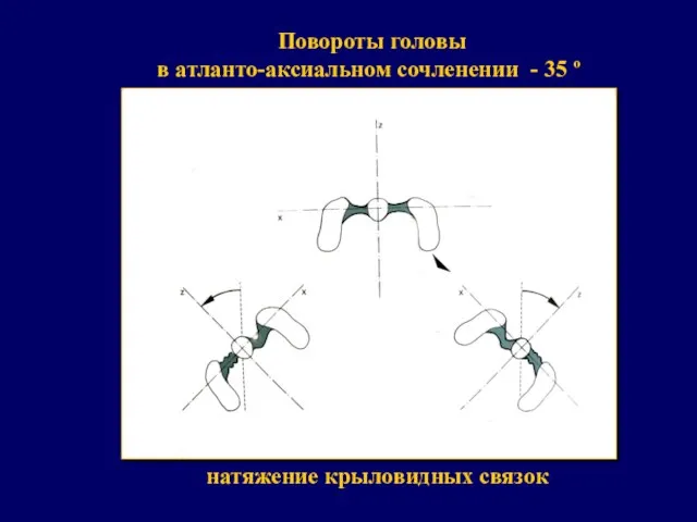 Повороты головы в атланто-аксиальном сочленении - 35 º натяжение крыловидных связок