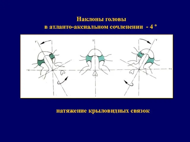 натяжение крыловидных связок Наклоны головы в атланто-аксиальном сочленении - 4 º