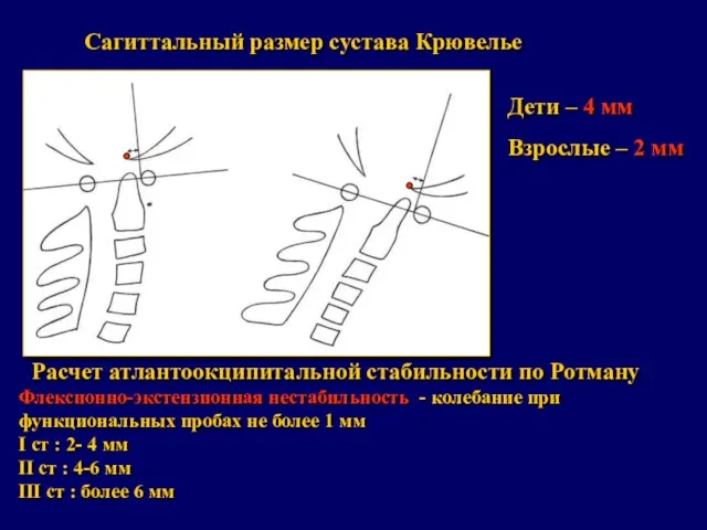 Сагиттальный размер сустава Крювелье Дети – 4 мм Взрослые – 2