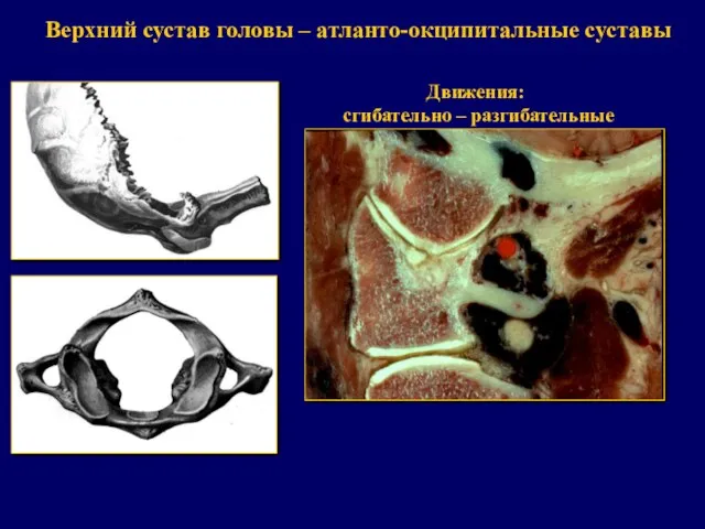 Верхний сустав головы – атланто-окципитальные суставы Движения: сгибательно – разгибательные