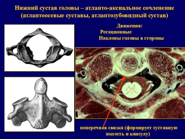 Нижний сустав головы – атланто-аксиальное сочленение (атлантоосевые суставы, атлантозубовидный сустав) Движения: