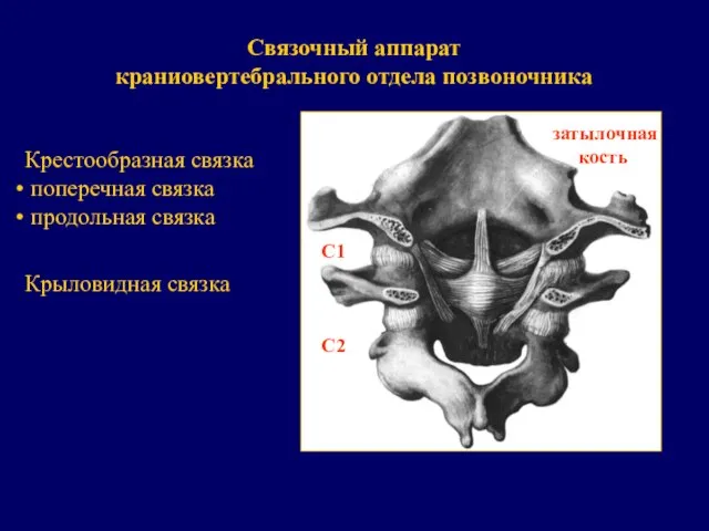 Связочный аппарат краниовертебрального отдела позвоночника Крестообразная связка поперечная связка продольная связка