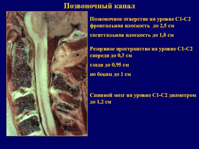 Позвоночный канал Резервное пространство на уровне С1-С2 спереди до 0,3 см