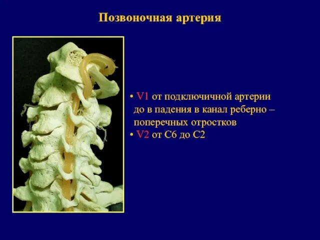 Позвоночная артерия V1 от подключичной артерии до в падения в канал