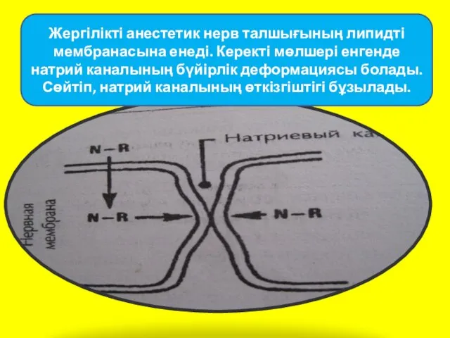 Жергілікті анестетик нерв талшығының липидті мембранасына енеді. Керекті мөлшері енгенде натрий