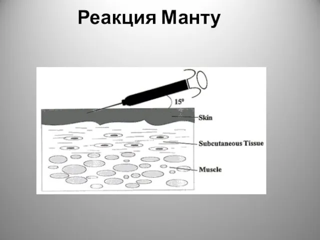 Реакция Манту