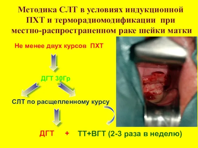 Методика СЛТ в условиях индукционной ПХТ и терморадиомодификации при местно-распространенном раке