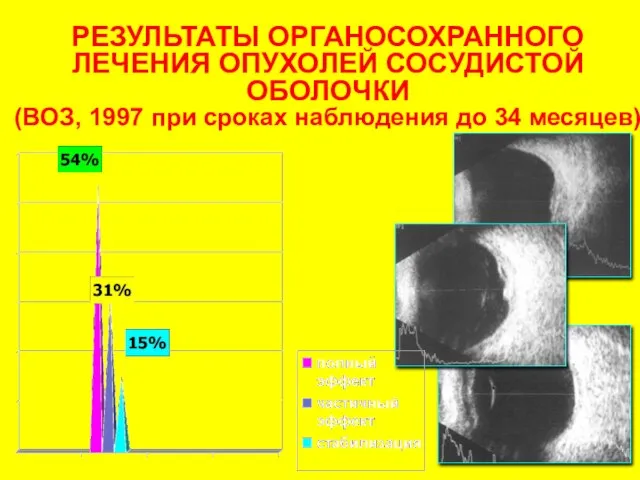 РЕЗУЛЬТАТЫ ОРГАНОСОХРАННОГО ЛЕЧЕНИЯ ОПУХОЛЕЙ СОСУДИСТОЙ ОБОЛОЧКИ (ВОЗ, 1997 при сроках наблюдения до 34 месяцев)