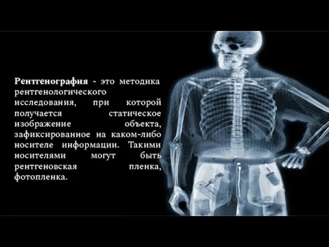 Рентгенография - это методика рентгенологического исследования, при которой получается статическое изображение