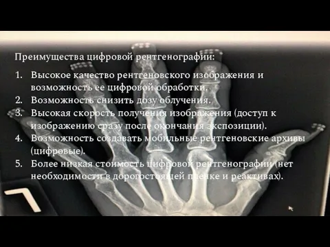 Преимущества цифровой рентгенографии: Высокое качество рентгеновского изображения и возможность ее цифровой