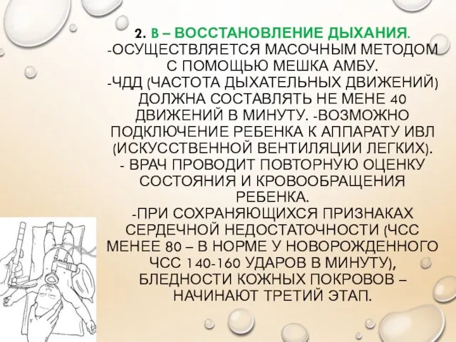 2. B – ВОССТАНОВЛЕНИЕ ДЫХАНИЯ. -ОСУЩЕСТВЛЯЕТСЯ МАСОЧНЫМ МЕТОДОМ С ПОМОЩЬЮ МЕШКА