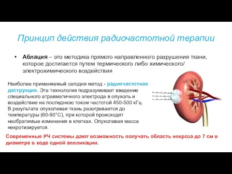 Принцип действия радиочастотной терапии Аблация – это методика прямого направленного разрушения