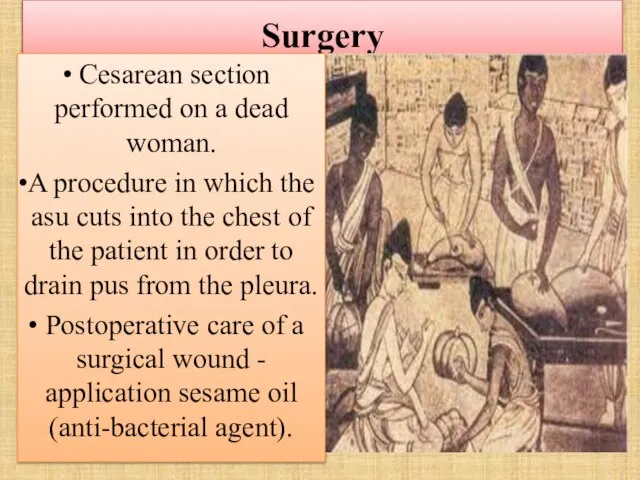 Surgery Cesarean section performed on a dead woman. A procedure in