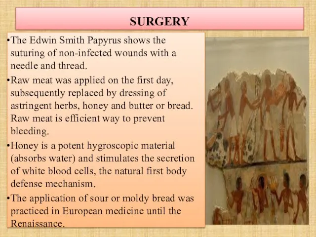 SURGERY The Edwin Smith Papyrus shows the suturing of non-infected wounds