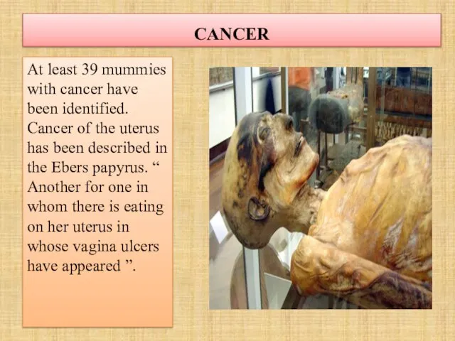 CANCER At least 39 mummies with cancer have been identified. Cancer