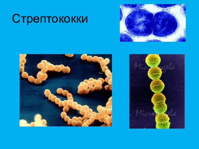 Стрептококки